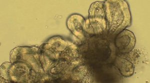 小鼠小肠类器官构建实战