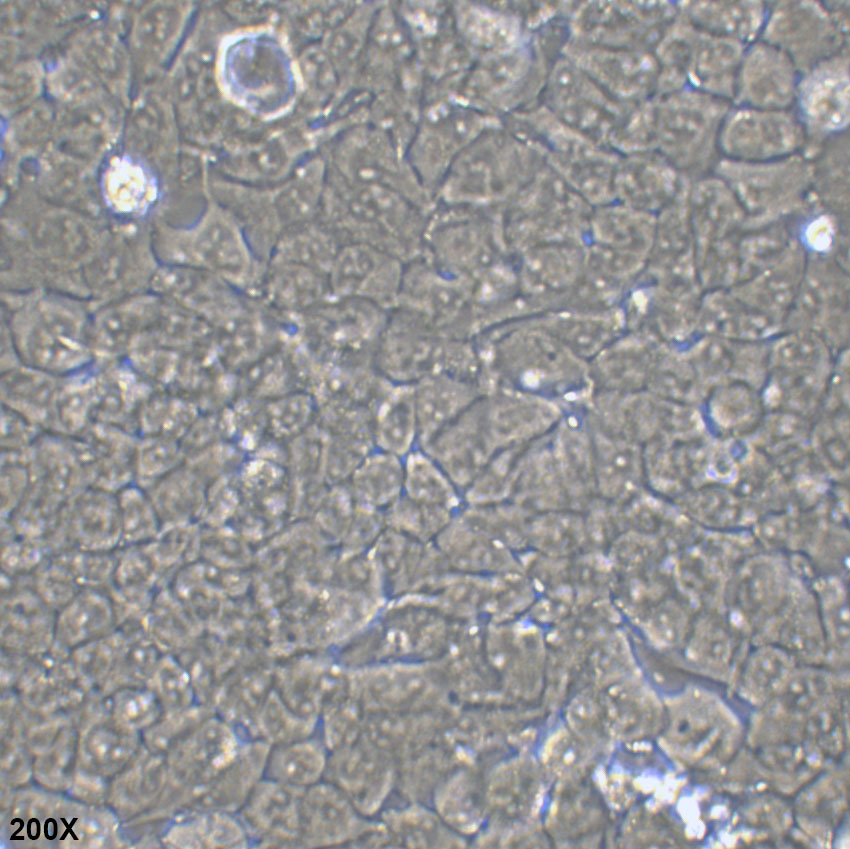 MHCC-LM3 人高转移潜能肝癌细胞