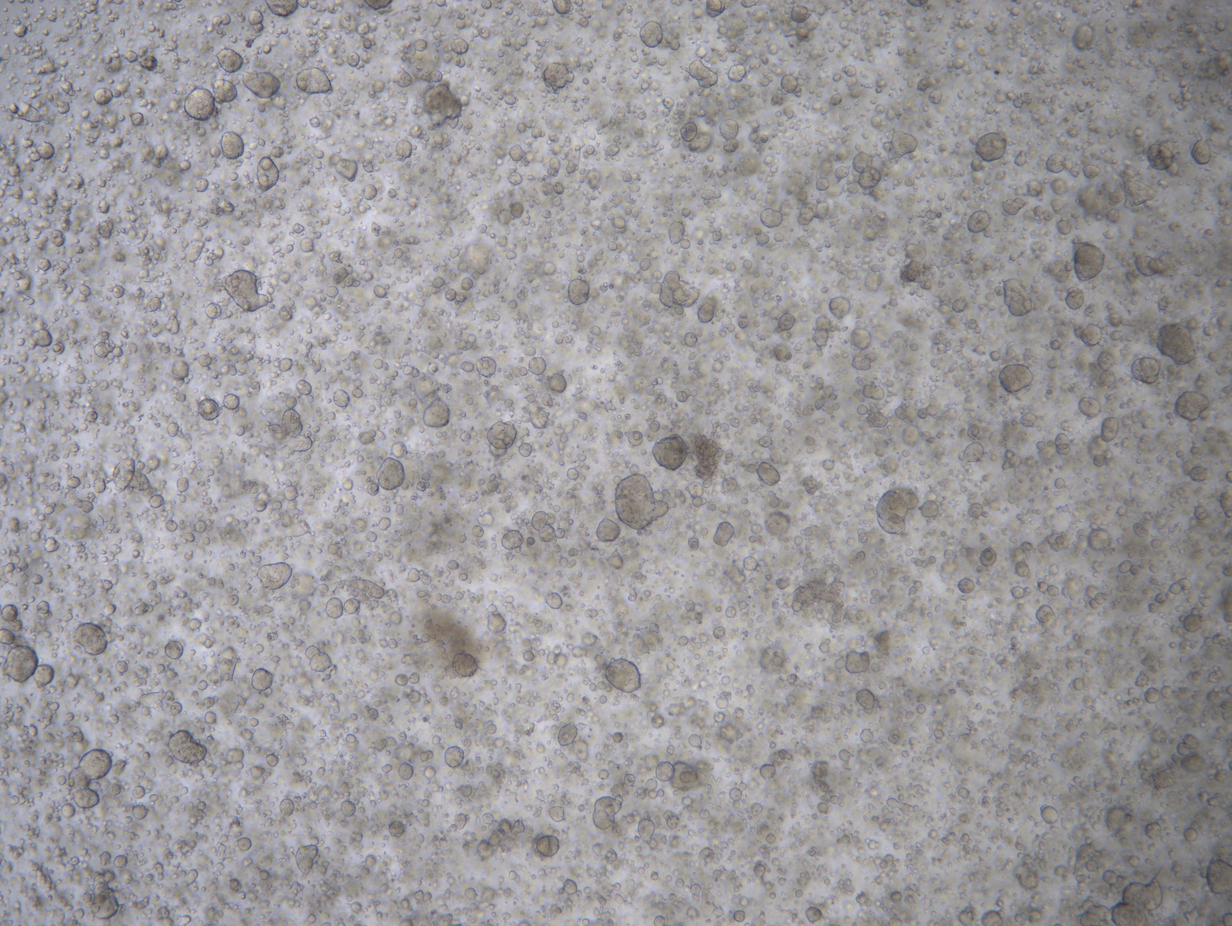 人子宫内膜癌类器官分离培养试剂盒/培养基